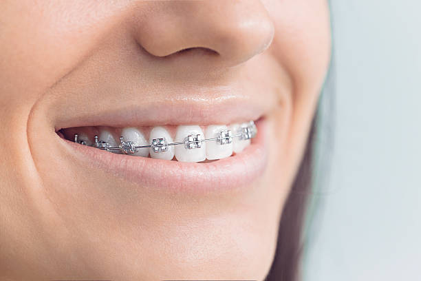 Best Dentures (Full and Partial)  in Springfield, MI